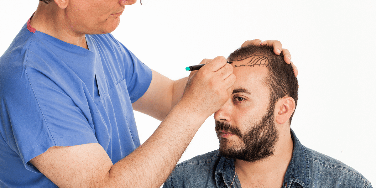 Hair Transplant
