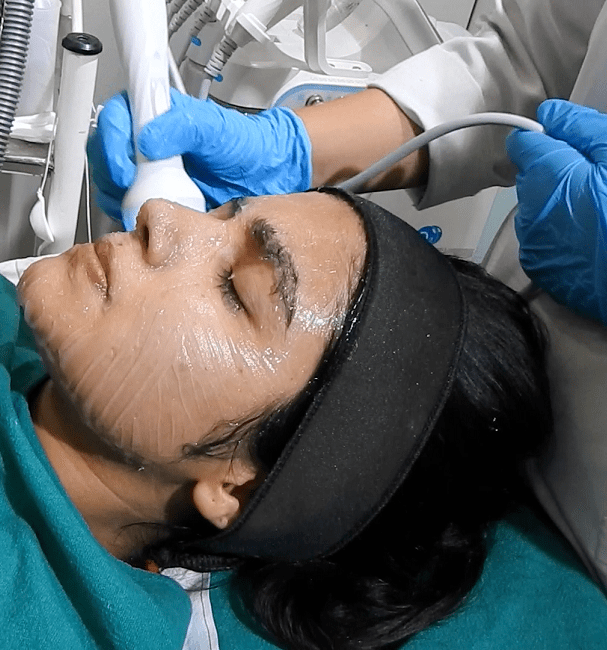 Medicated Facial (Hydra)